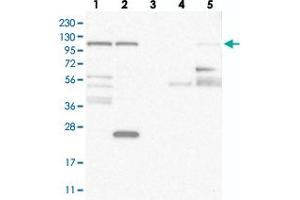 Western blot analysis of Lane 1: RT-4, Lane 2: U-251 MG, Lane 3: Human Plasma, Lane 4: Liver, Lane 5: Tonsil with WDR47 polyclonal antibody . (WDR47 抗体)