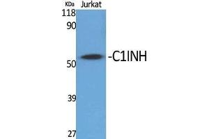 Western Blot (WB) analysis of specific cells using C1INH Polyclonal Antibody. (SERPING1 抗体  (Internal Region))