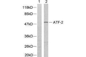 Western blot analysis of extracts from LOVO cells using ATF-2 (Ab-73 or 55) antibody (E021032). (ATF2 抗体)