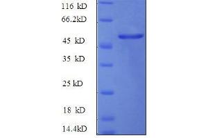 Hepatocyte Growth Factor (Hepapoietin A, Scatter Factor) (HGF) (AA 477-728) protein (GST tag) (HGF Protein (AA 477-728) (GST tag))