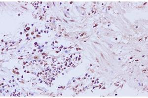 Immunohistochemistry of paraffin-embedded Human muscularis mucosa of the colon tissue using CCNL2 Polyclonal Antibody at dilution of 1:200 (Cyclin L2 抗体)