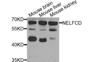 Western Blotting (WB) image for anti-TH1-Like (TH1L) (AA 355-599) antibody (ABIN6220747) (TH1-Like 抗体  (AA 355-599))