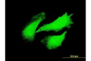 Immunofluorescence of monoclonal antibody to DYX1C1 on HeLa cell. (DYX1C1 抗体  (AA 336-420))