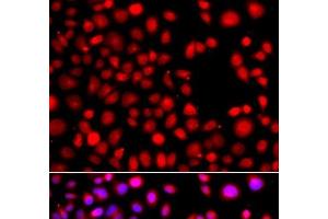 Immunofluorescence analysis of A549 cells using HLX Polyclonal Antibody (HLX 抗体)