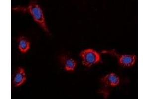 Immunofluorescent analysis of HER2 staining in HeLa cells. (ErbB2/Her2 抗体)