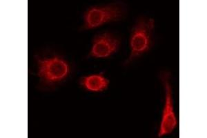 TMEM185A anticorps