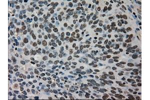 Immunohistochemical staining of paraffin-embedded Ovary tissue using anti-TMEM100mouse monoclonal antibody. (TMEM100 抗体)