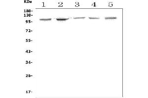 Western blot analysis of Ahr using anti-Ahr antibody (ABIN7600100).