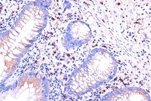 Immunohistochemistry of paraffin-embedded human appendix using C5 Rabbit pAb (ABIN6127535, ABIN6137777, ABIN6137778 and ABIN6219037) at dilution of 1:100 (40x lens). (C5AR1 抗体  (AA 250-350))