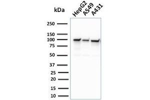 Western Blot Analysis of human HepG2, A549, and A431 cell lysate using MSH2 Mouse Monoclonal Antibody (MSH2/2622). (MSH2 抗体  (AA 327-427))