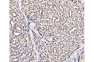 IHC analysis of SSB using anti-SSB antibody (ABIN7602125). (SSB 抗体  (AA 6-283))