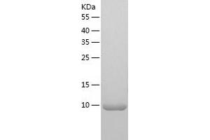 Western Blotting (WB) image for Zinc Finger Protein 100 (ZNF100) (AA 1-109) protein (His tag) (ABIN7125776) (ZNF100 Protein (AA 1-109) (His tag))
