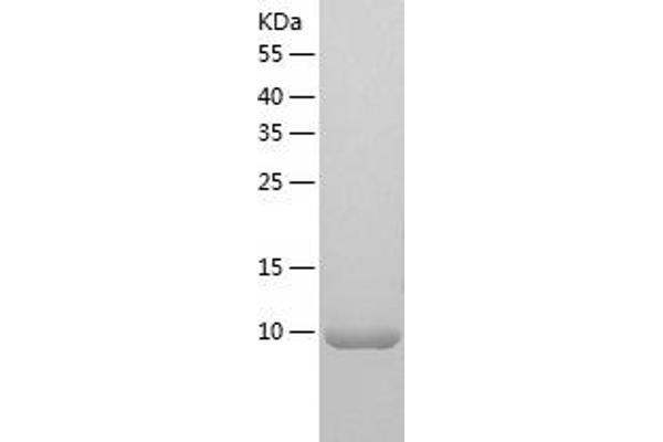 ZNF100 Protein (AA 1-109) (His tag)