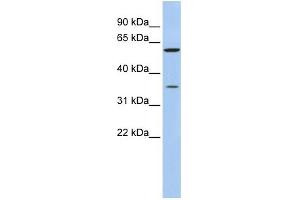 WB Suggested Anti-AKR1B1 Antibody Titration: 0. (AKR1B1 抗体  (N-Term))