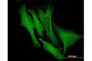 Immunofluorescence of monoclonal antibody to DCX on HeLa cell. (Doublecortin 抗体  (AA 1-360))