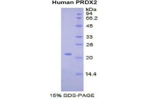 SDS-PAGE of Protein Standard from the Kit  (Highly purified E. (Peroxiredoxin 2 ELISA 试剂盒)