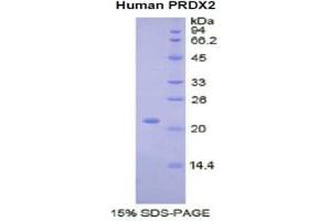 SDS-PAGE of Protein Standard from the Kit  (Highly purified E. (Peroxiredoxin 2 ELISA 试剂盒)