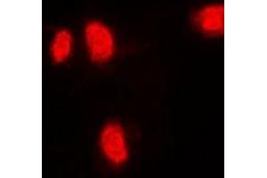 Immunofluorescent analysis of RANGAP1 staining in MCF7 cells. (RANGAP1 抗体)