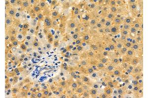 ABIN6265484 and ABIN6276350 at 1/100 staining Rat liver tissue by IHC-P. (TBRG4 抗体  (C-Term))
