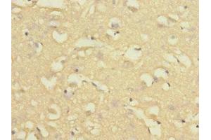 Immunohistochemistry of paraffin-embedded human brain tissue using ABIN7161622 at dilution of 1:100 (Nischarin 抗体  (AA 500-700))