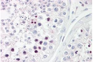 Anti-RFX3 antibody IHC staining of human testis. (RFX3 抗体  (AA 641-690))