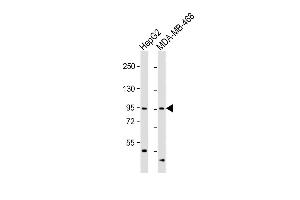 All lanes : Anti-OPHN1 Antibody (Center) at 1:1000 dilution Lane 1: HepG2 whole cell lysate Lane 2: MDA-MB-468 whole cell lysate Lysates/proteins at 20 μg per lane. (Oligophrenin 1 抗体  (AA 284-315))
