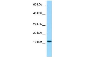 Host: Rabbit Target Name: C19orf10 Antibody Dilution: 1. (C19orf10 抗体  (Middle Region))