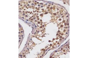 (ABIN6242872 and ABIN6578693) staining SLC2A8 in human testis tissue sections by Immunohistochemistry (IHC-P - paraformaldehyde-fixed, paraffin-embedded sections). (SLC2A8 抗体  (AA 260-292))