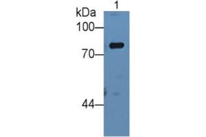 Western Blotting (WB) image for Complement Factor B (CFB) ELISA Kit (ABIN6720576)