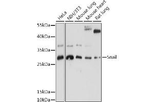 Western blot analysis of extracts of various cell lines, using Snail antibody (ABIN6134928, ABIN6148176, ABIN6148179 and ABIN6215911) at 1:1000 dilution. (SNAIL 抗体  (C-Term))