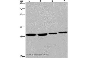 Western blot analysis of 293T and LoVo cell, mouse skin tissue and A172 cell, using ETV7 Polyclonal Antibody at dilution of 1:600 (ETV7 抗体)