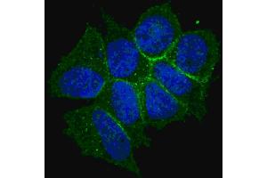 Fluorescent confocal image of MCF7 cells stained with phospho-ERBB2- antibody. (ErbB2/Her2 抗体  (pThr1166))