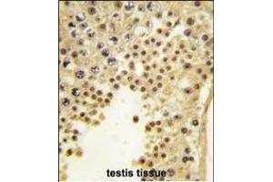 Formalin-fixed and paraffin-embedded human testis tissue reacted with JHDM1a/FBXL11 antibody (Center) (ABIN387896 and ABIN2844142) , which was peroxidase-conjugated to the secondary antibody, followed by DAB staining. (KDM2A 抗体  (AA 500-527))