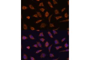 Immunofluorescence analysis of L929 cells using C antibody (ABIN7266029) at dilution of 1:100. (CAMSAP1 抗体  (AA 350-650))