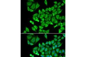 Immunofluorescence analysis of U2OS cells using DHRS9 Polyclonal Antibody (DHRS9 抗体)