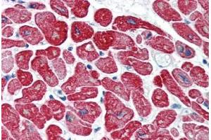 Human Heart (formalin-fixed, paraffin-embedded) stained with TPM1 antibody ABIN337101 at 5 ug/ml followed by biotinylated anti-mouse IgG secondary antibody ABIN481714, alkaline phosphatase-streptavidin and chromogen. (Tropomyosin 抗体)