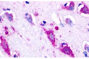Image no. 1 for anti-G Protein-Coupled Receptor 22 (GPR22) (N-Term) antibody (ABIN1048779) (GPR22 抗体  (N-Term))