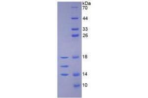 Image no. 1 for Interleukin 15 (IL15) (AA 50-162) (Active) protein (His tag) (ABIN5665839)