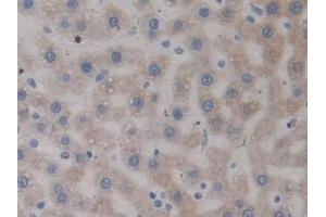 Detection of RAGE in Rat Liver Tissue using Polyclonal Antibody to Receptor For Advanced Glycation Endproducts (RAGE) (RAGE 抗体  (AA 180-402))