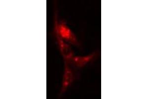 ABIN6266570 staining A-431 cells by IF/ICC. (KRT17 抗体  (C-Term))