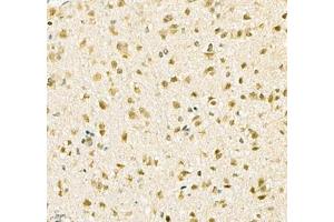 Immunohistochemistry (Paraffin-embedded Sections) (IHC (p)) image for anti-Potassium Voltage-Gated Channel, Subfamily H (Eag-Related), Member 5 (KCNH5) antibody (ABIN7075159)