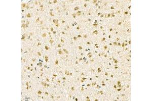 Immunohistochemistry of paraffin embedded mouse brain using Kcnh5 (ABIN7075159) at dilution of 1:100 (400x lens)