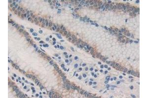 Immunohistochemistry (IHC) image for anti-Acetyl-CoA Acetyltransferase 2 (ACAT2) (AA 1-397) antibody (ABIN7435556)