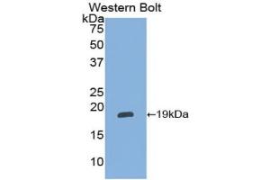 Western blot analysis of the recombinant protein. (alpha 2 Antiplasmin 抗体  (AA 348-491))