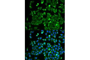 Immunofluorescence analysis of HeLa cells using NF2 antibody (ABIN5971315). (Merlin 抗体)