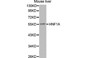 Western blot analysis of extracts of mouse liver, using HNF1A antibody (ABIN5971580). (HNF1A 抗体)