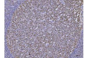 IHC analysis of MSH2 using anti-MSH2 antibody (ABIN7601369). (MSH2 抗体  (AA 337-583))