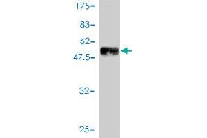 Western Blot detection against Immunogen (47. (PDGFRA 抗体  (AA 25-218))