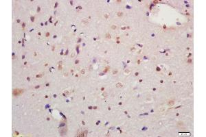Formalin-fixed and paraffin embedded rat brain labeled with Anti-MAPK organizer 1 Polyclonal Antibody, Unconjugated (ABIN720475) at 1:200 followed by conjugation to the secondary antibody and DAB staining (MORG1 抗体  (AA 201-315))