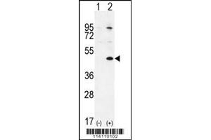 Western blot analysis of TGIF1 using rabbit polyclonal using 293 cell lysates (2 ug/lane) either nontransfected (Lane 1) or transiently transfected (Lane 2) with the TGIF1 gene. (TGIF1 抗体  (AA 208-237))